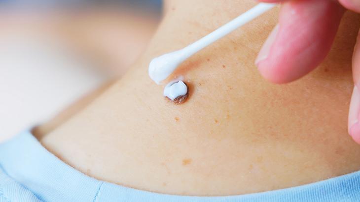 lazerle aldiran da var solusyon suren de her ben masum degil incelenmeli PDLywTaV.jpg